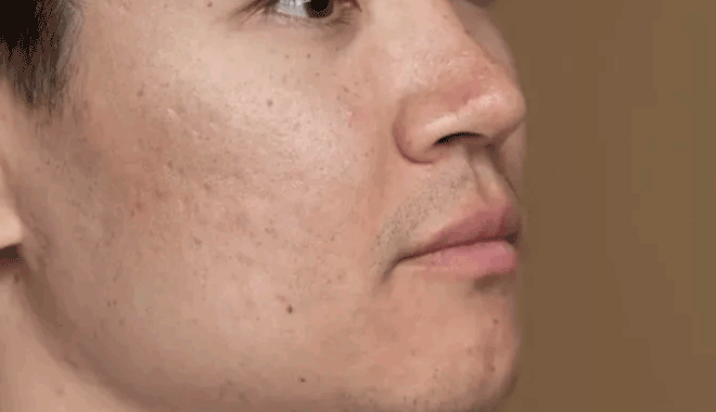 cara mengecilkan pori-pori wajah secara alami