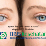 Operasi Katarak dengan BPJS