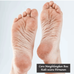 Cara Menghilangkan Bau Kaki secara Permanen